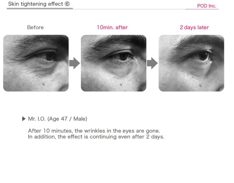 Eye patches with a rose Rosy drop Stretch Sheets eye patches- 60 pcs - Koreancare