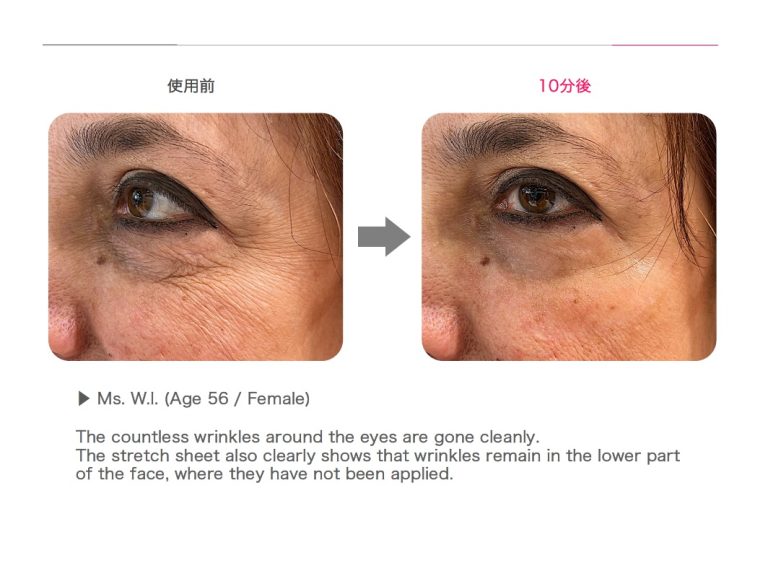 Eye patches with a rose Rosy drop Stretch Sheets eye patches- 60 pcs - Koreancare