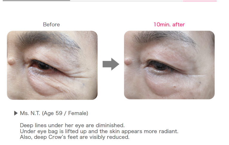 Eye patches with a rose Rosy drop Stretch Sheets eye patches- 60 pcs - Koreancare