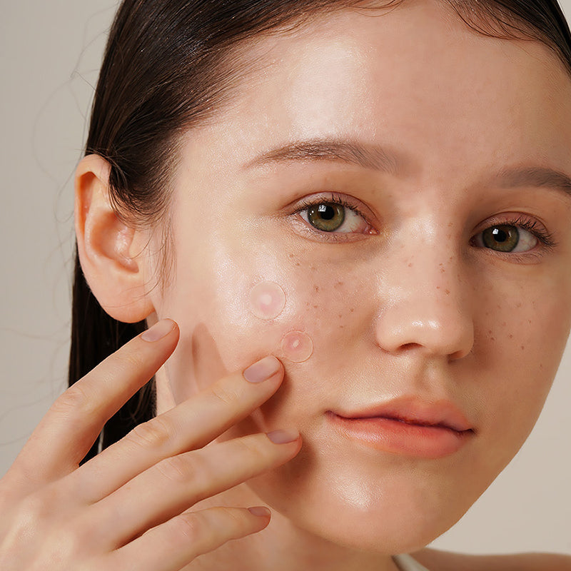 ISNTREE ONION NEWPAIR SPOT PATCH - Koreancare