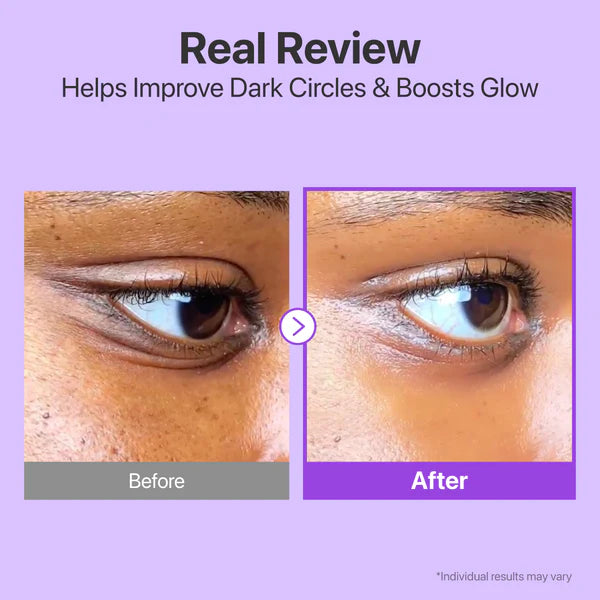 Numbuzin No.9 NAD Retinol Volumetox Eye Cream 10ml - Koreancare