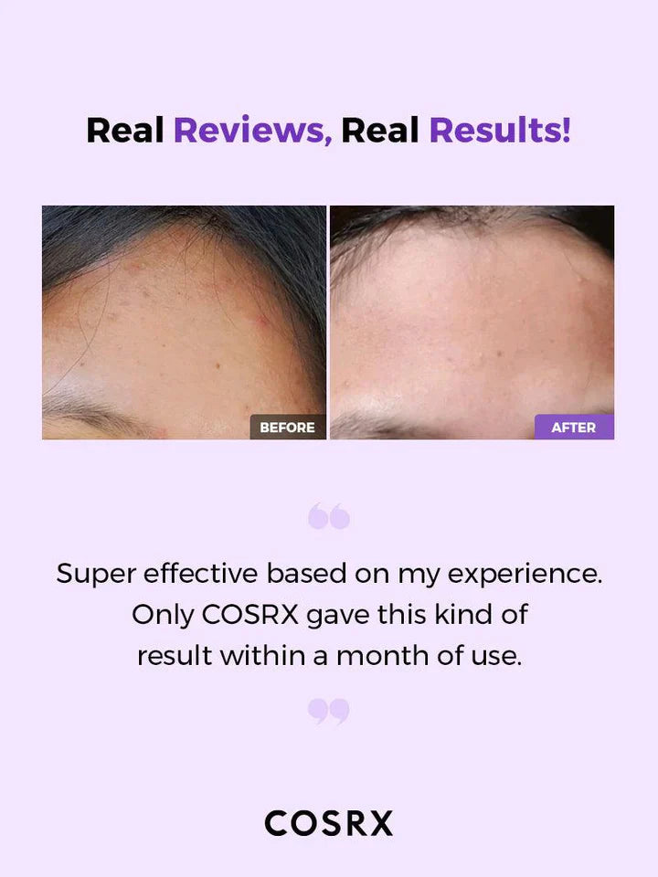 Exfoliating toner COSRX - AHA/BHA Clarifying Treatment Toner
