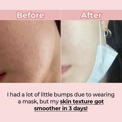 Numbuzin No,3 Skin Softening Serum - Koreancare