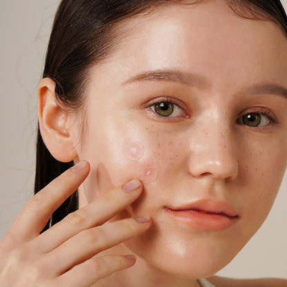 ISNTREE ONION NEWPAIR SPOT PATCH - Koreancare